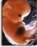 Dagegen eindeutigt erkennbar: Embryo eines Menschen